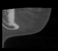 OKC All Cases project thumbnail
