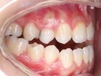 ToothOurDatas project thumbnail