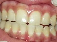 ToothNew project thumbnail