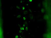 fibroBlastDetection project thumbnail