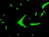 fibroBlastFollowUp project thumbnail