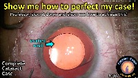 K_CC_1087_perfect your case project thumbnail