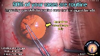 K_CC_1309_90% routine project thumbnail