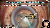 K_CC_1378_young surgeon chop project thumbnail