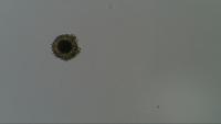 Cell_Detection project thumbnail