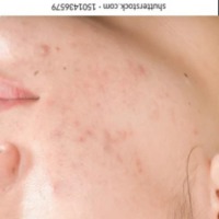 skin disease project thumbnail