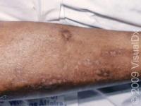 skin segmentation process project thumbnail
