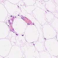 lizard_w_segmentation project thumbnail