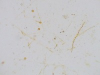lineanotatae project thumbnail