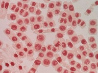 cells project thumbnail
