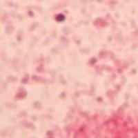 gram_stain_bacteria_ptf project thumbnail