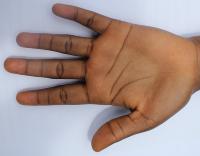 Palm-Line-Detection project thumbnail