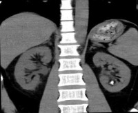 ct_scan project thumbnail