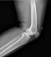 knee_lat project thumbnail