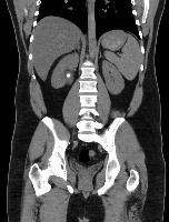 Detect Kidney in CT Images project thumbnail