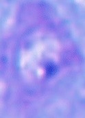 cells detection project thumbnail