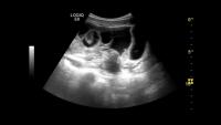 ultrasound_anno3 project thumbnail