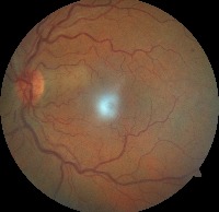Dataset Image