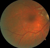 Dataset Image