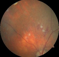 Dataset Image