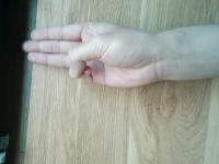 Hand Therapy Exercise v2 project thumbnail