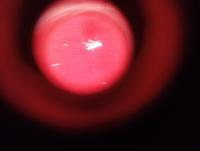 segmentation project thumbnail