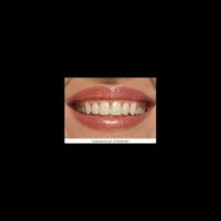 Tooth project thumbnail