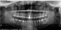 teeth project thumbnail