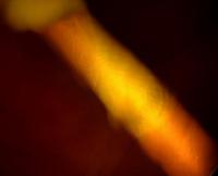bladdercancer12345 project thumbnail
