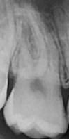 teeth project thumbnail