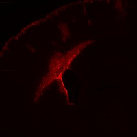 Brain project thumbnail