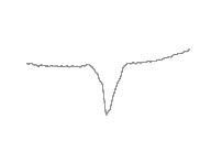 SOP_arrhythmea_classification project thumbnail