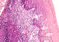 Histo 2 project thumbnail