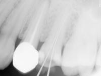 det project thumbnail