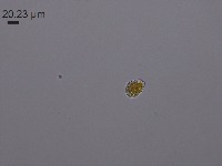 Spore-2122 project thumbnail