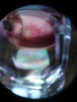 Cervical  project thumbnail