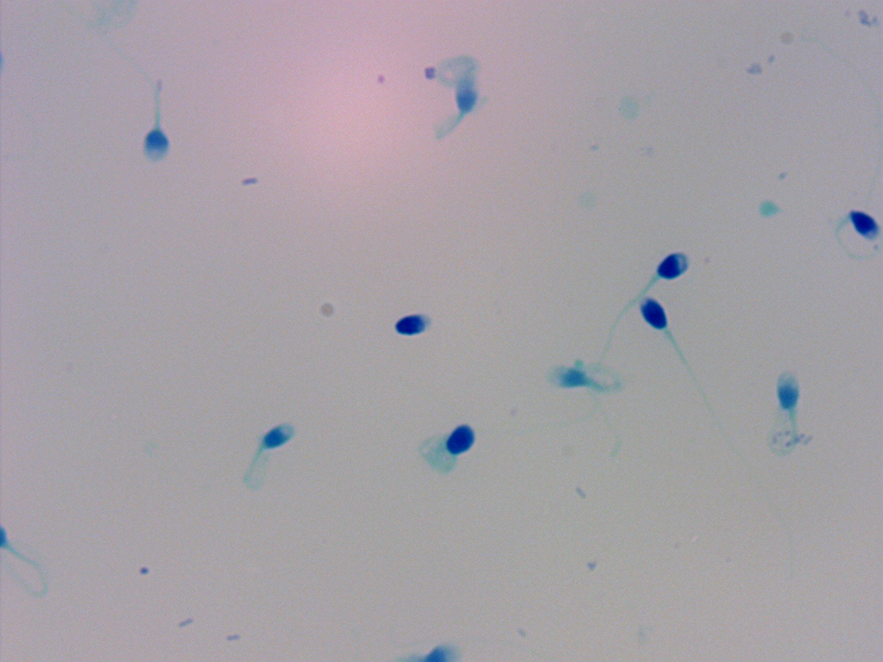 Sperm Detection Sperm Quality Detection Object Detection Model by Asha C S
