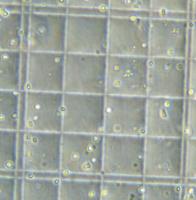 cells_counter 2 project thumbnail