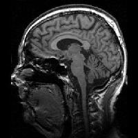 brain project thumbnail