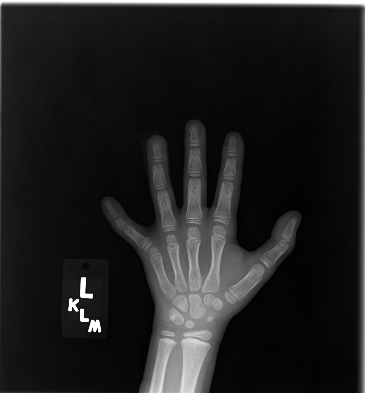 Hand_joint_detect_with_female_dataset Object Detection Dataset and Pre ...