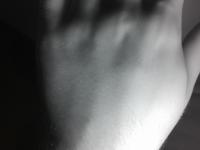 Vein-Segmentation-Project project thumbnail