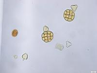 Pollen image detection project thumbnail