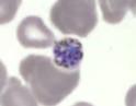 P. malariae project thumbnail