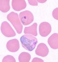 P. vivax project thumbnail