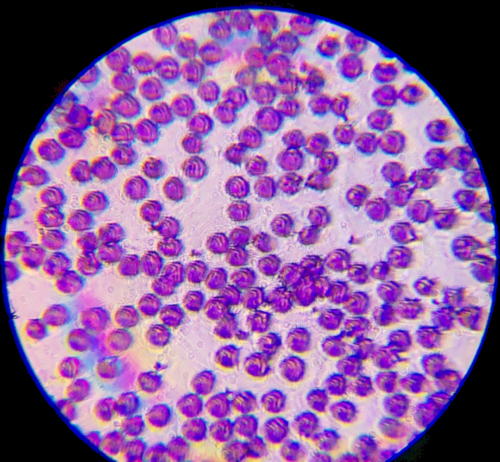 blood-cell Object Detection Model by bloodcell