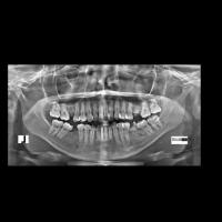 Rovemedic_AI_Segmentation_Final project thumbnail
