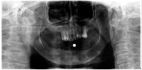 Anatomy Landmark Detection Project project thumbnail