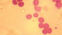 babesia project thumbnail