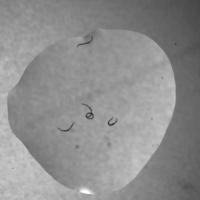 C.elegans project thumbnail