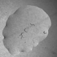 C.elegans project thumbnail